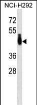 PABPC4L Antibody (C-term) western blot analysis in NCI-H292 cell line lysates (35ug/lane).This demonstrates the PABPC4L antibody detected the PABPC4L protein (arrow).