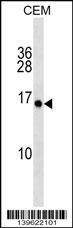 PLGLA Antibody (N-term) western blot analysis in CEM cell line lysates (35ug/lane).This demonstrates the PLGLA antibody detected the PLGLA protein (arrow).