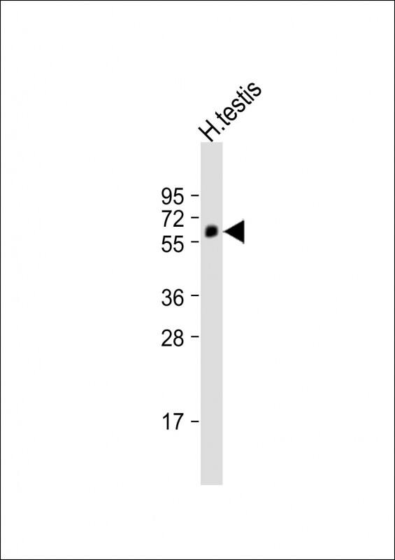 Anti-POTEM Antibody (C-term) at 1:2000 dilution + human testis lysateLysates/proteins at 20 �g per lane. SecondaryGoat Anti-Rabbit IgG, (H+L), Peroxidase conjugated at 1/10000 dilution. Predicted band size : 57 kDaBlocking/Dilution buffer: 5% NFDM/TBST.