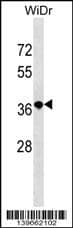 RN3L1 Antibody (C-term) western blot analysis in WiDr cell line lysates (35ug/lane).This demonstrates the RN3L1 antibody detected the RN3L1 protein (arrow).