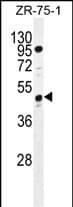 SPMIP7 Antibody (C-term) western blot analysis in ZR-75-1 cell line lysates (35ug/lane).This demonstrates the SPMIP7 antibody detected the SPMIP7 protein (arrow).
