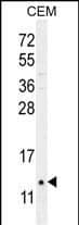 C15orf37 Antibody (C-term) western blot analysis in CEM cell line lysates (35ug/lane).This demonstrates the C15orf37 antibody detected the C15orf37 protein (arrow).