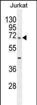TBC1D3H Antibody (N-term) western blot analysis in Jurkat cell line lysates (35ug/lane).This demonstrates the TBC1D3H antibody detected the TBC1D3H protein (arrow).