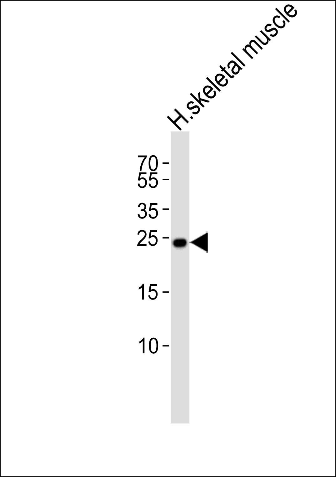Western blot analysis of lysate from human skeletal muscle tissue lysate, using TMEM239 Antibody (N-term). was diluted at 1:1000. A goat anti-rabbit IgG H&L(HRP) at 1:5000 dilution was used as the secondary antibody. Lysate at 35ug.