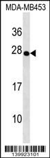 TRDC Antibody (Center) western blot analysis in MDA-MB453 cell line lysates (35ug/lane).This demonstrates the TRDC antibody detected the TRDC protein (arrow).