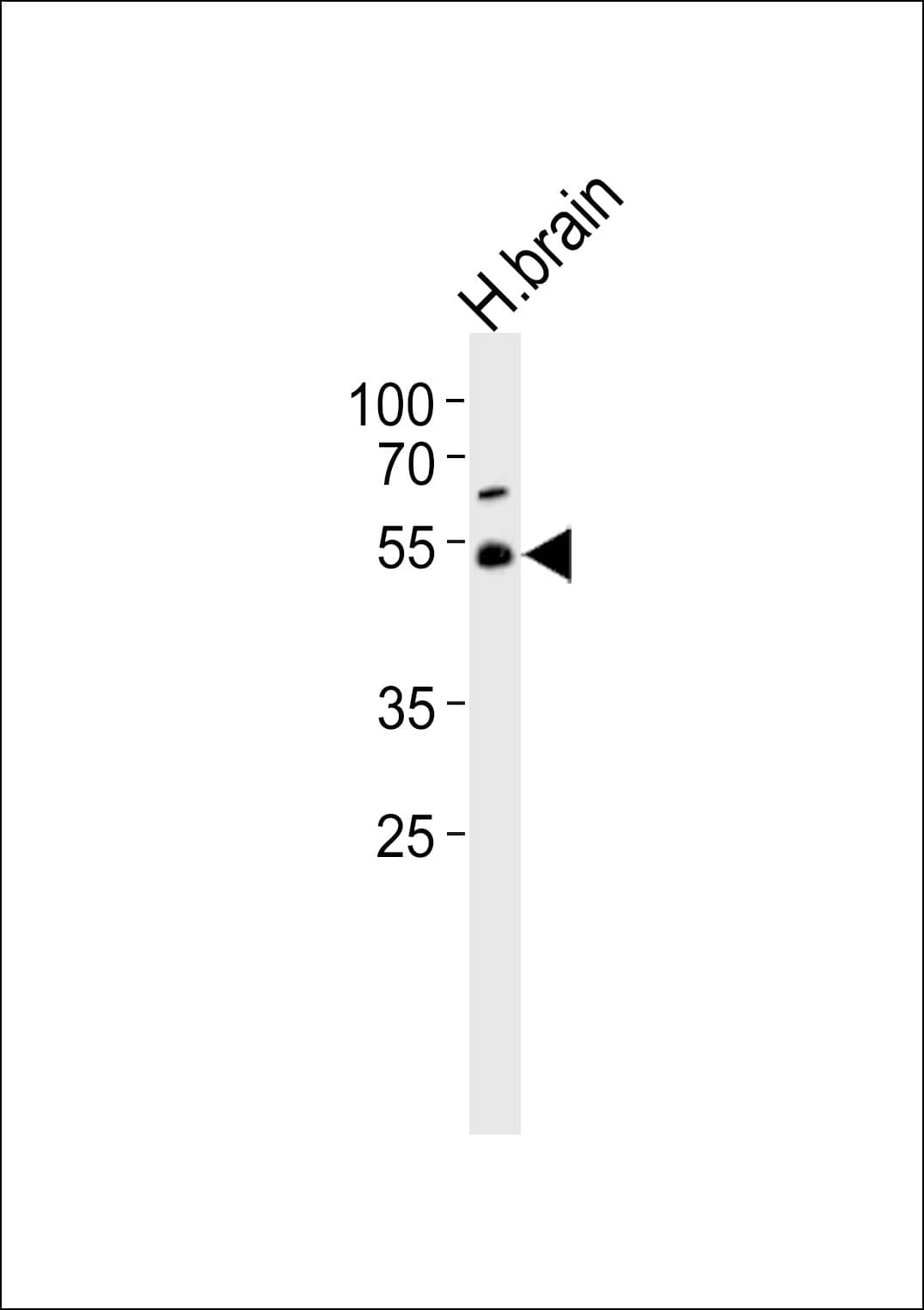 Western Blot TRIM43B Antibody (RB49774)