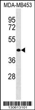 WASH2P Antibody (N-term) western blot analysis in MDA-MB453 cell line lysates (35ug/lane).This demonstrates the WASH2P antibody detected the WASH2P protein (arrow).