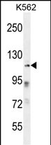ZNF99 Antibody (N-term) western blot analysis in K562 cell line lysates (35ug/lane).This demonstrates the ZNF99 antibody detected the ZNF99 protein (arrow).