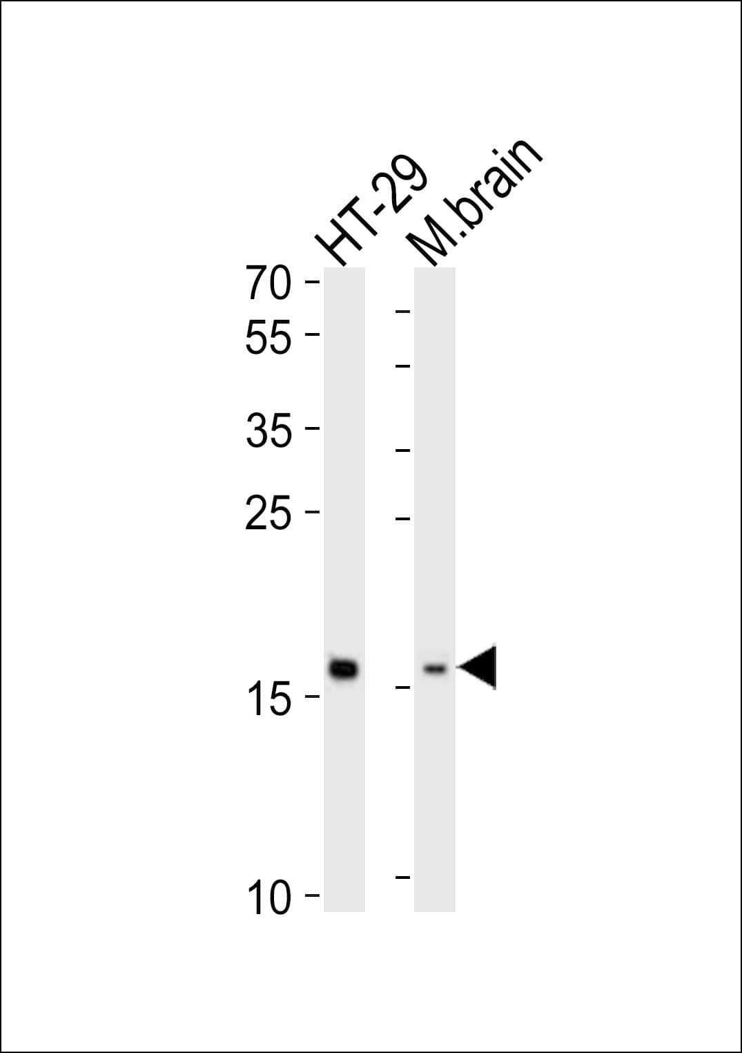 Western Blot TMEM160 Antibody (RB49633)