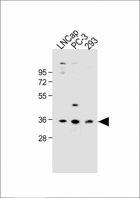 Western Blot OR6C3 Antibody (RB49992)