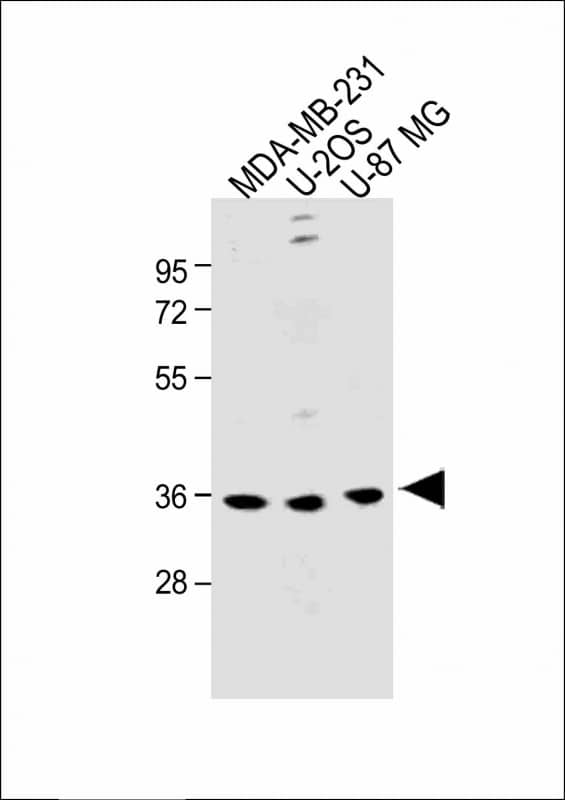 Western Blot OR6C3 Antibody (RB49992)