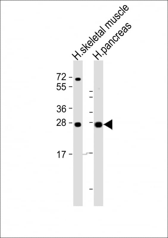 All lanes : Anti-CELA2B Antibody (Center) at 1:2000 dilutionLane 1: human skeletal muscle lysateLane 2: human pancreas lysateLysates/proteins at 20 �g per lane. SecondaryGoat Anti-Rabbit IgG, (H+L), Peroxidase conjugated at 1/10000 dilution. Predicted band size : 29 kDaBlocking/Dilution buffer: 5% NFDM/TBST.