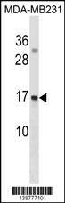 GABARibody (Center) western blot analysis in MDA-MB231 cell line lysates (35ug/lane).This demonstrates the GABARibody detected the GABARAPL3 protein (arrow).