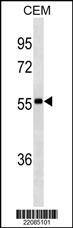 lgA Antibody (Center)(Ascites) western blot analysis in CEM cell line lysates (35?g/lane).This demonstrates the lgA antibody detected the lgA protein (arrow).