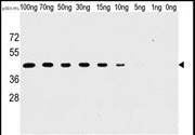 Western blot analysis of anti-H1L Mab in recombinant pGEX-H1L protein. H1L(arrow) was detected using the purified Mab.