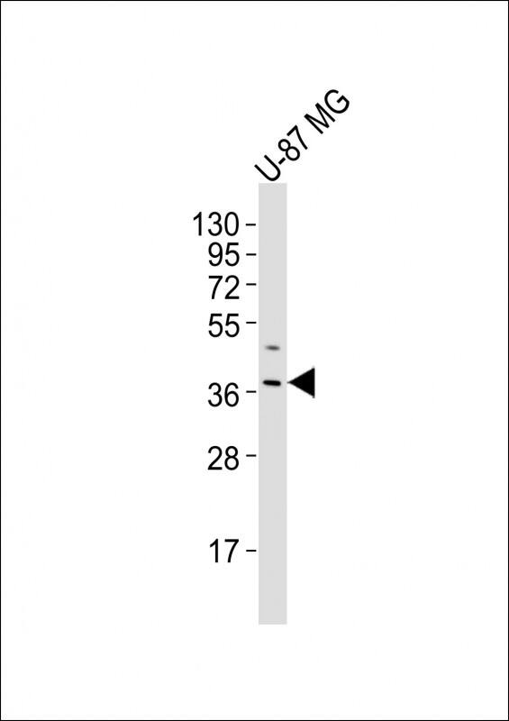 Anti-OR4K17 Antibody (Center) at 1:500 dilution + U-87 MG whole cell lysatesLysates/proteins at 20 �g per lane. SecondaryGoat Anti-Rabbit IgG, (H+L), Peroxidase conjugated at 1/10000 dilutionPredicted band size : 35 kDaBlocking/Dilution buffer: 5% NFDM/TBST.