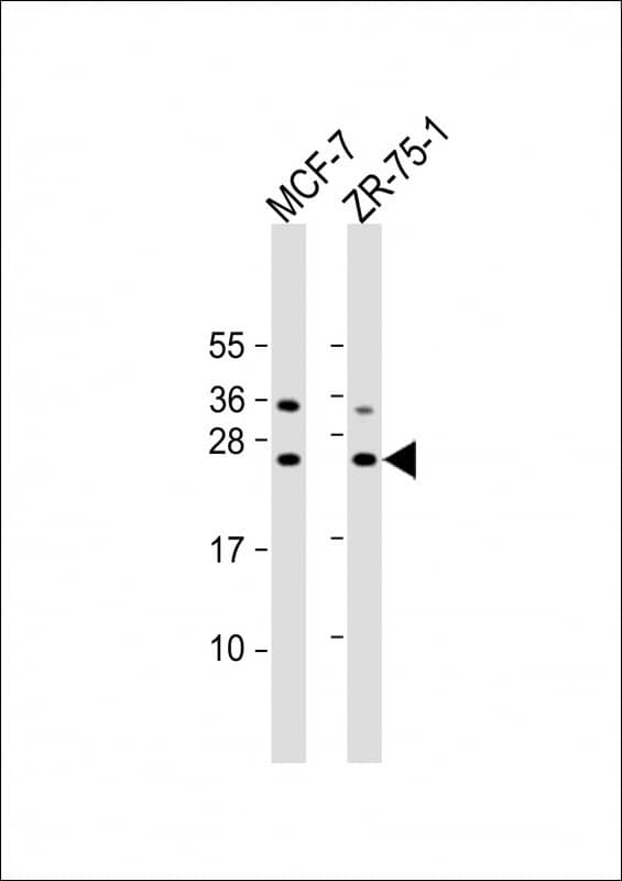 All lanes : Anti-STAG3L1 Antibody (Center) at 1:2000 dilutionLane 1: human testis lysateLane 2: MCF-7 whole cell lysateLane 3: MOLT-4 whole cell lysateLysates/proteins at 20 �g per lane. SecondaryGoat Anti-Rabbit IgG, (H+L), Peroxidase conjugated at 1/10000 dilution. Predicted band size : 24 kDaBlocking/Dilution buffer: 5% NFDM/TBST.