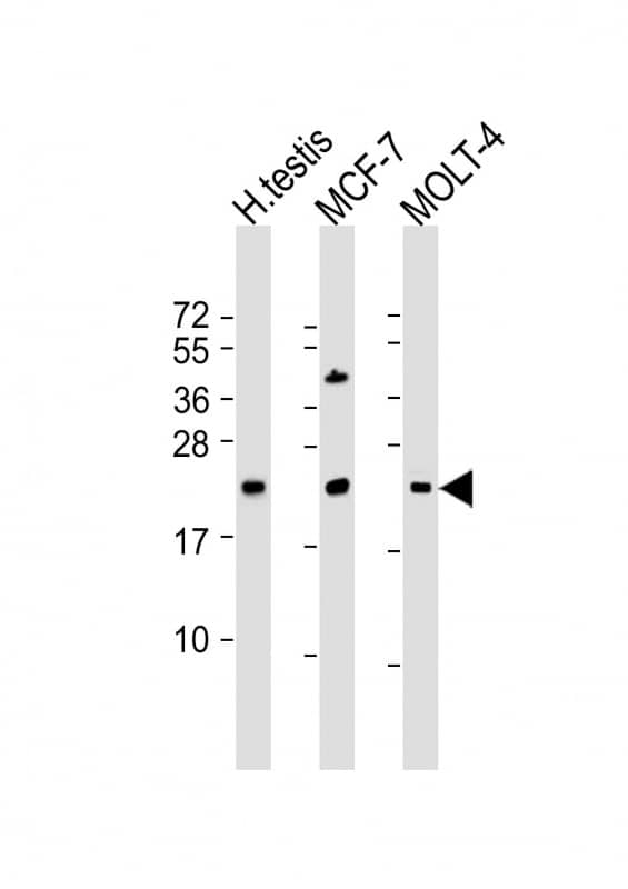 All lanes : Anti-STAG3L1 Antibody (Center) at 1:2000 dilutionLane 1: human testis lysateLane 2: MCF-7 whole cell lysateLane 3: MOLT-4 whole cell lysateLysates/proteins at 20 �g per lane. SecondaryGoat Anti-Rabbit IgG, (H+L), Peroxidase conjugated at 1/10000 dilution. Predicted band size : 24 kDaBlocking/Dilution buffer: 5% NFDM/TBST.
