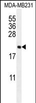 UNQ3104 Antibody (N-term) western blot analysis in MDA-MB231 cell line lysates (35ug/lane).This demonstrates the UNQ3104 antibody detected the UNQ3104 protein (arrow).