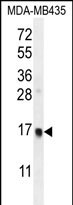 UNQ6493 Antibody (C-term) western blot analysis in MDA-MB435 cell line lysates (35ug/lane).This demonstrates the UNQ6493 antibody detected the UNQ6493 protein (arrow).