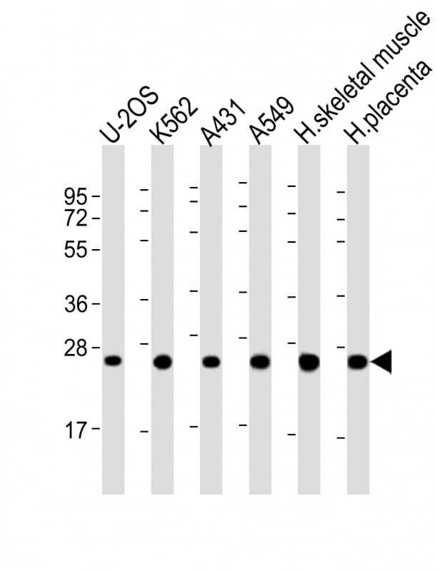All lanes : Anti-UQCRFS1 Antibody (Center) at 1:2000 dilutionLane 1: U-2OS whole cell lysateLane 2: K562 whole cell lysateLane 3: A431 whole cell lysateLane 4: A549 whole cell lysateLane 5: human skeletal muscle lysateLane 6: human placenta lysateLysates/proteins at 20 �g per lane. SecondaryGoat Anti-Rabbit IgG, (H+L), Peroxidase conjugated at 1/10000 dilution. Predicted band size : 31 kDaBlocking/Dilution buffer: 5% NFDM/TBST.