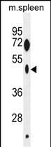 Western Blot ZNF385C Antibody (RB29285)