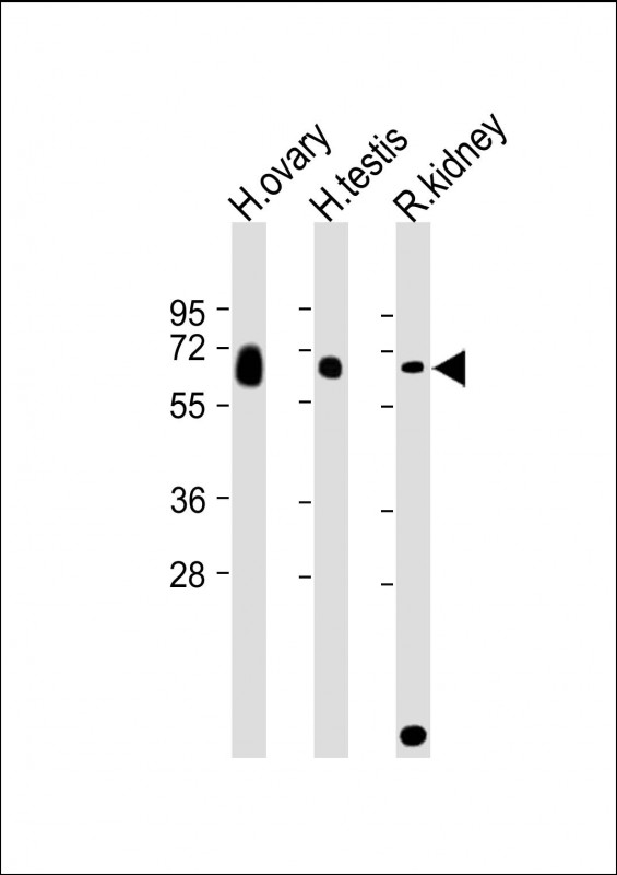 All lanes : Anti-GGT3P Antibody (C-Term) at 1:2000 dilutionLane 1: Human ovary lysateLane 2: Human testis lysateLane 3: Rat kidney lysateLysates/proteins at 20 �g per lane. SecondaryGoat Anti-Rabbit IgG, (H+L), Peroxidase conjugated at 1/10000 dilution. Predicted band size : 62 kDaBlocking/Dilution buffer: 5% NFDM/TBST.