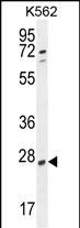 RPEL1 Antibody (C-term) western blot analysis in K562 cell line lysates (35ug/lane).This demonstrates the RPEL1 antibody detected the RPEL1 protein (arrow).