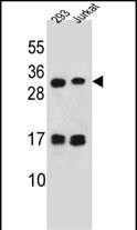 LOC339742 Antibody (C-term) western blot analysis in 293,Jurkat cell line lysates (35ug/lane).This demonstrates the LOC339742 antibody detected the LOC339742 protein (arrow).