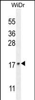 Confocal immunofluorescent analysis of UNQ5814 Antibody (C-term) with WiDr cell followed by Alexa Fluor 488-conjugated goat anti-rabbit lgG (green). Dused to stain the cell nuclear (blue).