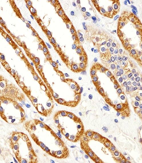 Immunohistochemistry-Paraffin CYS1 Antibody (RB49884)