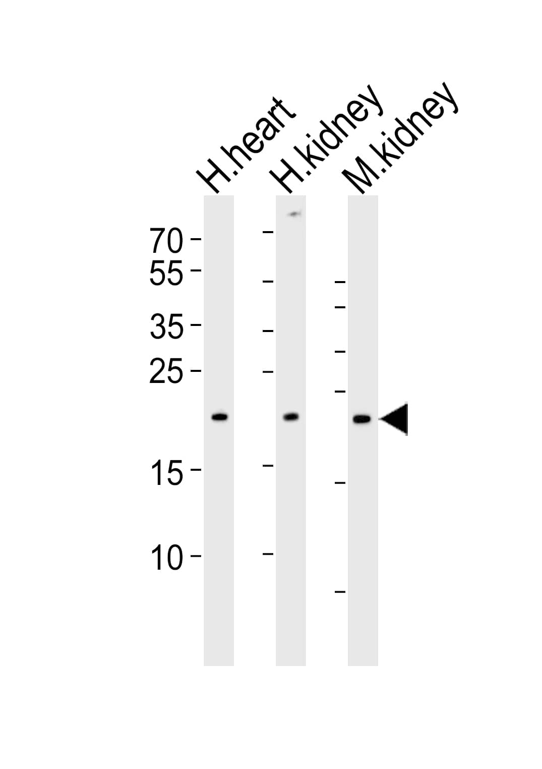 Western Blot CYS1 Antibody (RB49884)