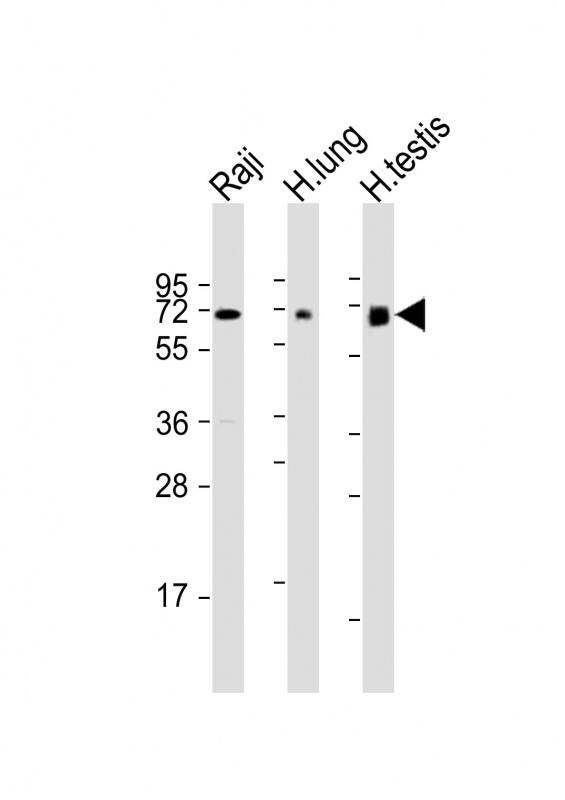 All lanes : Anti-ERVK-7 Antibody (N-Term) at 1:1000-1:2000 dilutionLane 1: Raji whole cell lysateLane 2: human lung lysateLane 3: human testis lysateLysates/proteins at 20 �g per lane. SecondaryGoat Anti-Rabbit IgG, (H+L), Peroxidase conjugated at 1/10000 dilution. Predicted band size : 67 kDaBlocking/Dilution buffer: 5% NFDM/TBST.
