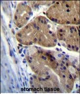 Immunohistochemistry-Paraffin DCDC1 Antibody (RB29404)