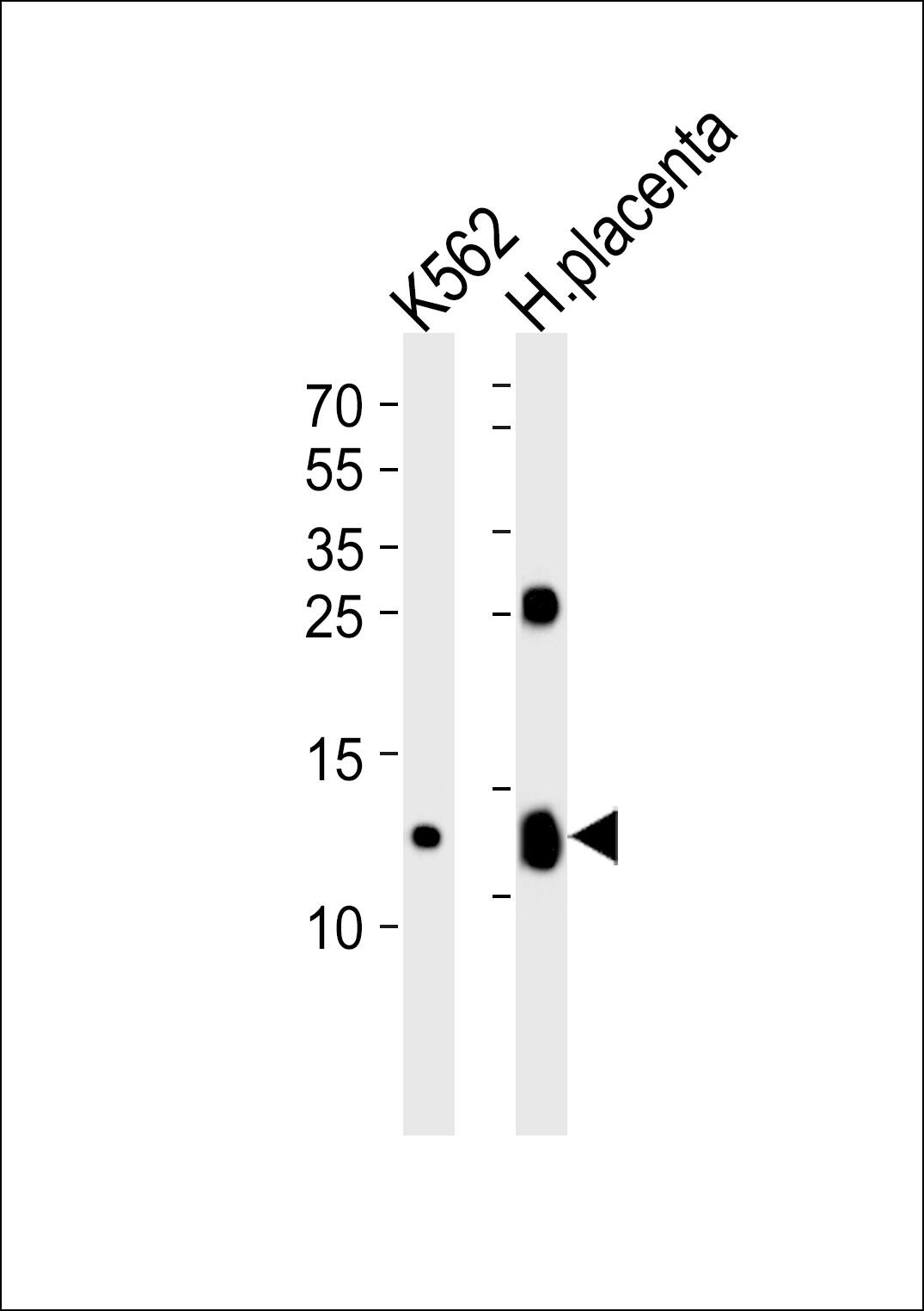 Western blot analysis of lysates from K562 cell line and human placenta tissue lysate (from left to right), using HBG2 Antibody (C-term). was diluted at 1:1000 at each lane. A goat anti-rabbit IgG H&L(HRP) at 1:5000 dilution was used as the secondary antibody. Lysates at 35ug per lane.