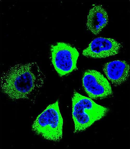 Confocal immunofluorescent analysis of TUBB8B Antibody (C-term) with NCI-H460 cell followed by Alexa Fluor 488-conjugated goat anti-rabbit lgG (green). Dused to stain the cell nuclear (blue).