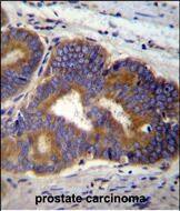 Confocal immunofluorescent analysis of TUBB8B Antibody (C-term) with NCI-H460 cell followed by Alexa Fluor 488-conjugated goat anti-rabbit lgG (green). Dused to stain the cell nuclear (blue).
