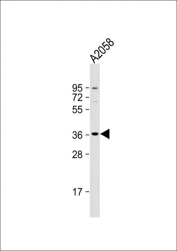 Anti-OR52J3 Antibody (C-term) at 1:1000 dilution + A2058 whole cell lysateLysates/proteins at 20 �g per lane. SecondaryGoat Anti-Rabbit IgG, (H+L), Peroxidase conjugated at 1/10000 dilution. Predicted band size : 35 kDaBlocking/Dilution buffer: 5% NFDM/TBST.