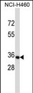 OR14C36 Antibody (C-term) western blot analysis in NCI-H460 cell line lysates (35ug/lane).This demonstrates the OR14C36 antibody detected the OR14C36 protein (arrow).