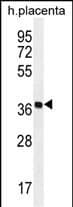 OR5AS1 Antibody (C-term) western blot analysis in human placenta tissue lysates (35ug/lane).This demonstrates the OR5AS1 antibody detected the OR5AS1 protein (arrow).
