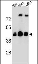 OR4C13 Antibody (N-term) western blot analysis in 293,Hela,Jurkat cell line lysates (35ug/lane).This demonstrates the OR4C13 antibody detected the OR4C13 protein (arrow).