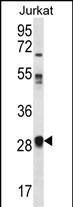 OR11L1 Antibody (C-term) western blot analysis in Jurkat cell line lysates (35ug/lane).This demonstrates the OR11L1 antibody detected the OR11L1 protein (arrow).