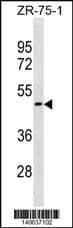 OR1S2 Antibody (C-term) western blot analysis in ZR-75-1 cell line lysates (35ug/lane).This demonstrates the OR1S2 antibody detected the OR1S2 protein (arrow).