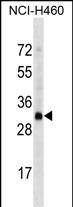 Western Blot OR4D2 Antibody (RB35430)