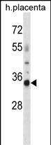 Western Blot OR4K13 Antibody (RB31581)