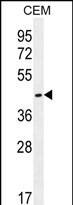 Western Blot OR8H2 Antibody (RB29997)