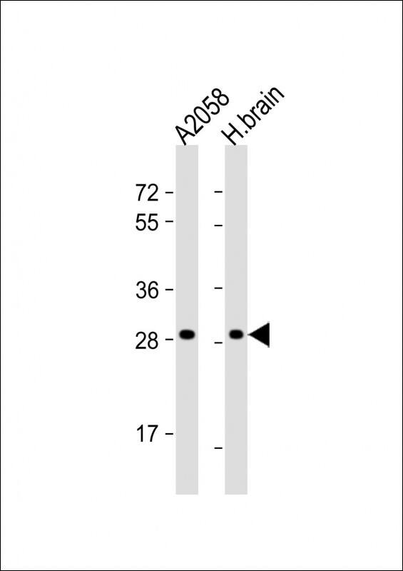 All lanes : Anti-OR4F17 Antibody (N-term) at 1:1000 dilutionLane 1: A2058 whole cell lysateLane 2: human brain lysateLysates/proteins at 20 �g per lane. SecondaryGoat Anti-Rabbit IgG, (H+L), Peroxidase conjugated at 1/10000 dilution. Predicted band size : 34 kDaBlocking/Dilution buffer: 5% NFDM/TBST.