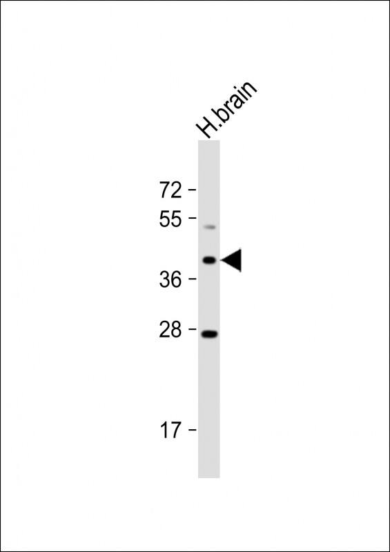 Anti-OR5M8 Antibody (C-term) at 1:1000 dilution + human brain lysateLysates/proteins at 20 �g per lane. SecondaryGoat Anti-Rabbit IgG, (H+L), Peroxidase conjugated at 1/10000 dilution. Predicted band size : 36 kDaBlocking/Dilution buffer: 5% NFDM/TBST.
