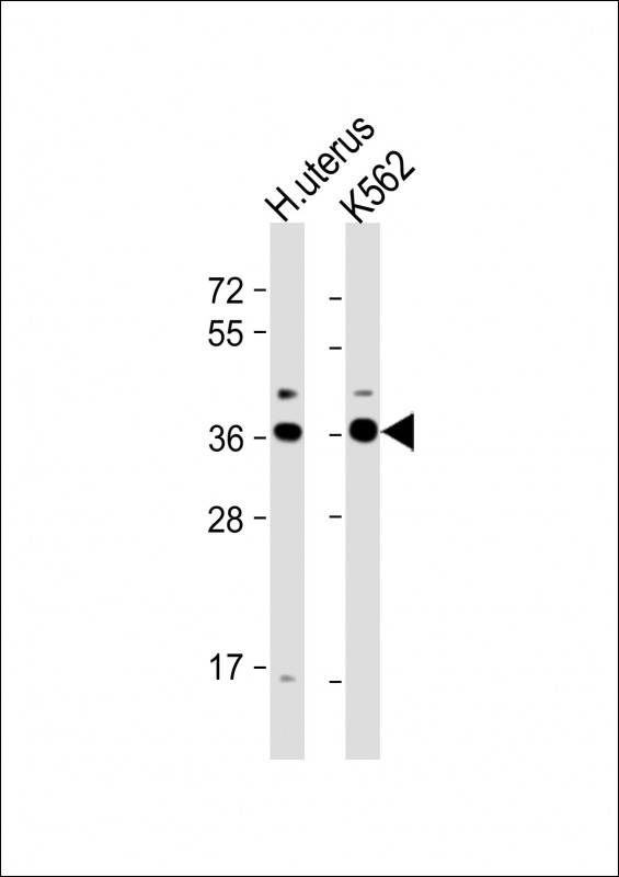 All lanes : Anti-OR52H1 Antibody (C-term) at 1:1000 dilutionLane 1: human uterus lysateLane 2: K562 whole cell lysateLysates/proteins at 20 �g per lane. SecondaryGoat Anti-Rabbit IgG, (H+L), Peroxidase conjugated at 1/10000 dilution. Predicted band size : 36 kDaBlocking/Dilution buffer: 5% NFDM/TBST.