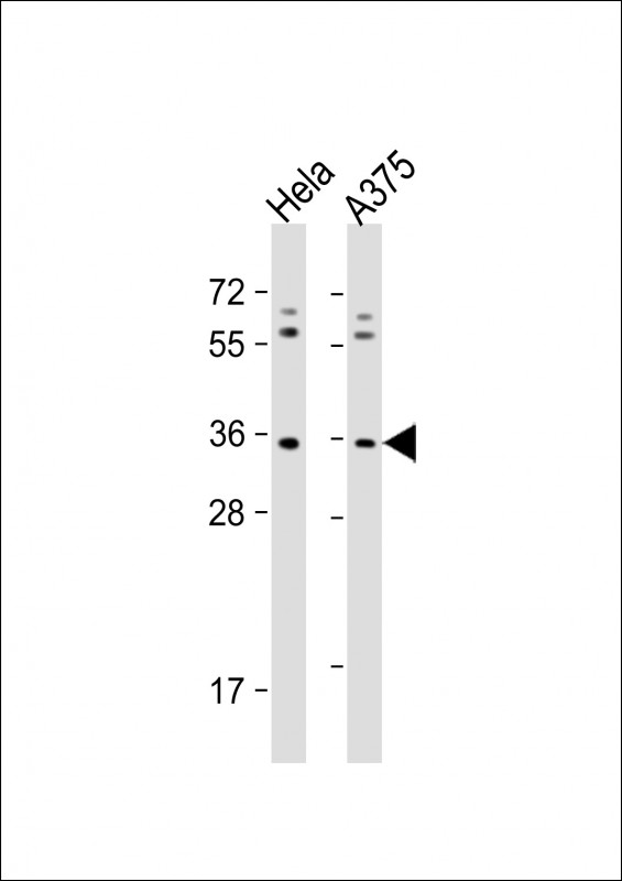 All lanes : Anti-OR5AK2 Antibody (C-term) at 1:1000 dilutionLane 1: Hela whole cell lysateLane 2: A375 whole cell lysateLysates/proteins at 20 �g per lane. SecondaryGoat Anti-Rabbit IgG, (H+L), Peroxidase conjugated at 1/10000 dilution. Predicted band size : 35 kDaBlocking/Dilution buffer: 5% NFDM/TBST.